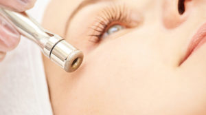 Microdermabrasion