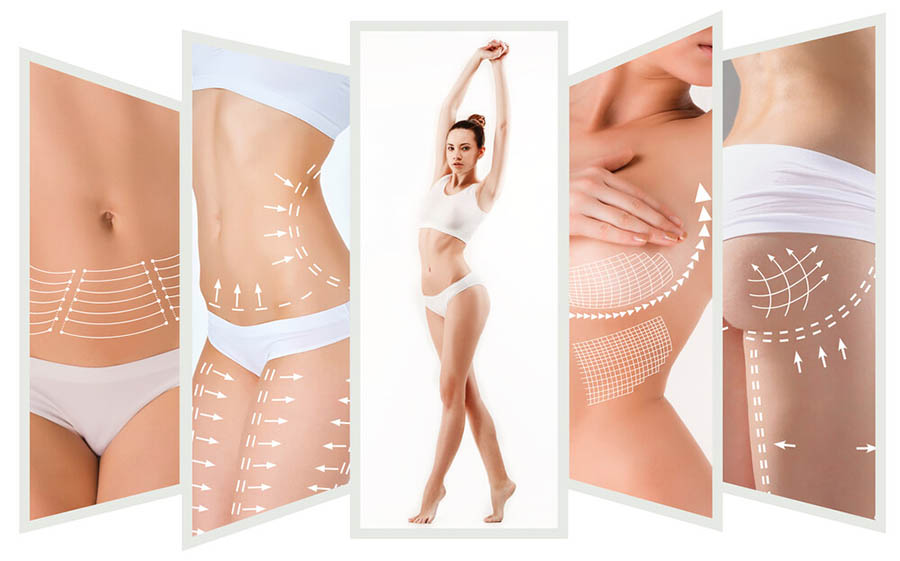 Ultrasound Cavitation & Radio Frequency