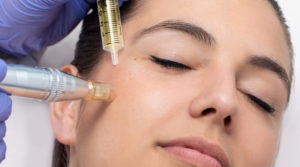 The Beauty Training Portal- Micro needling